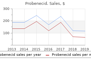 order probenecid with mastercard